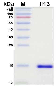 SDS-PAGE Image