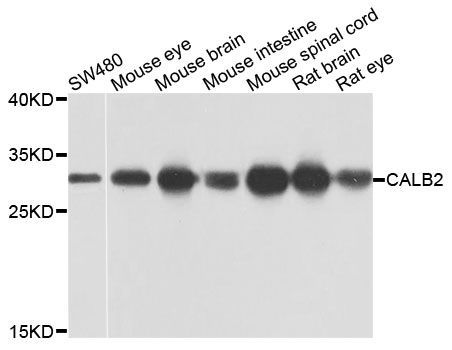 Western blot - CALB2 Polyclonal Antibody (144-09807)