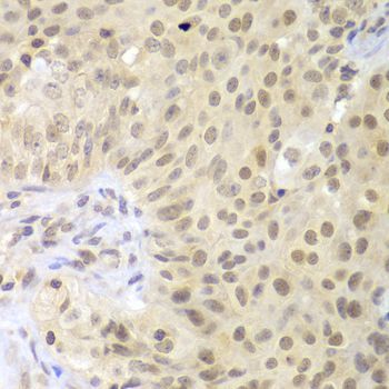 Immunohistochemistry - LHX4 antibody (144-08072)