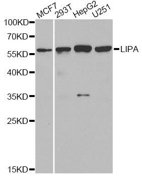 Western blot - LIPA antibody (144-06385)