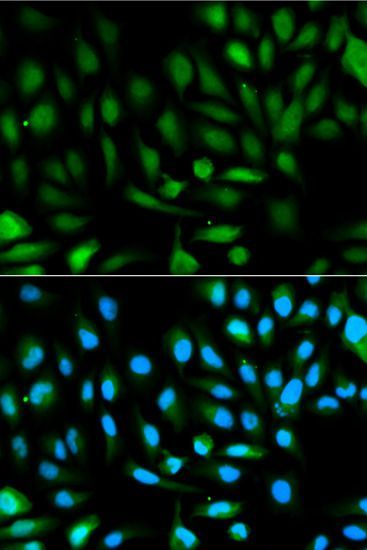 Western blot - [KO Validated] PARK7 Polyclonal Antibody (144-00987)
