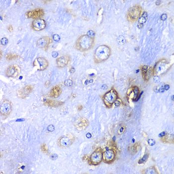 Immunohistochemistry - RPS3A Polyclonal Antibody (144-05885)