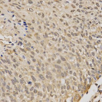 Immunohistochemistry - STK11 antibody (144-02122)