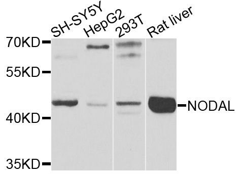 Western blot - NODAL antibody (144-09902)