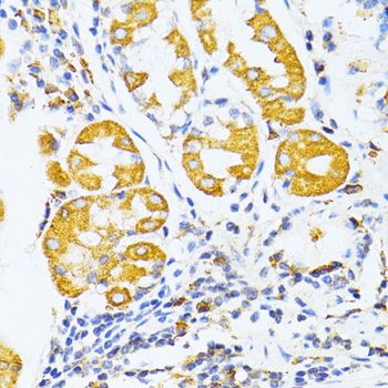 Immunohistochemistry - MMP2 antibody (144-06247)