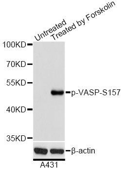 Western blot - Phospho-VASP-S157 pAb (144-61511)