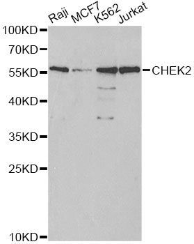 Western blot - CHEK2 Polyclonal Antibody (144-60023)