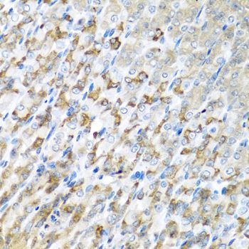 Immunohistochemistry - CST1 antibody (144-06570)