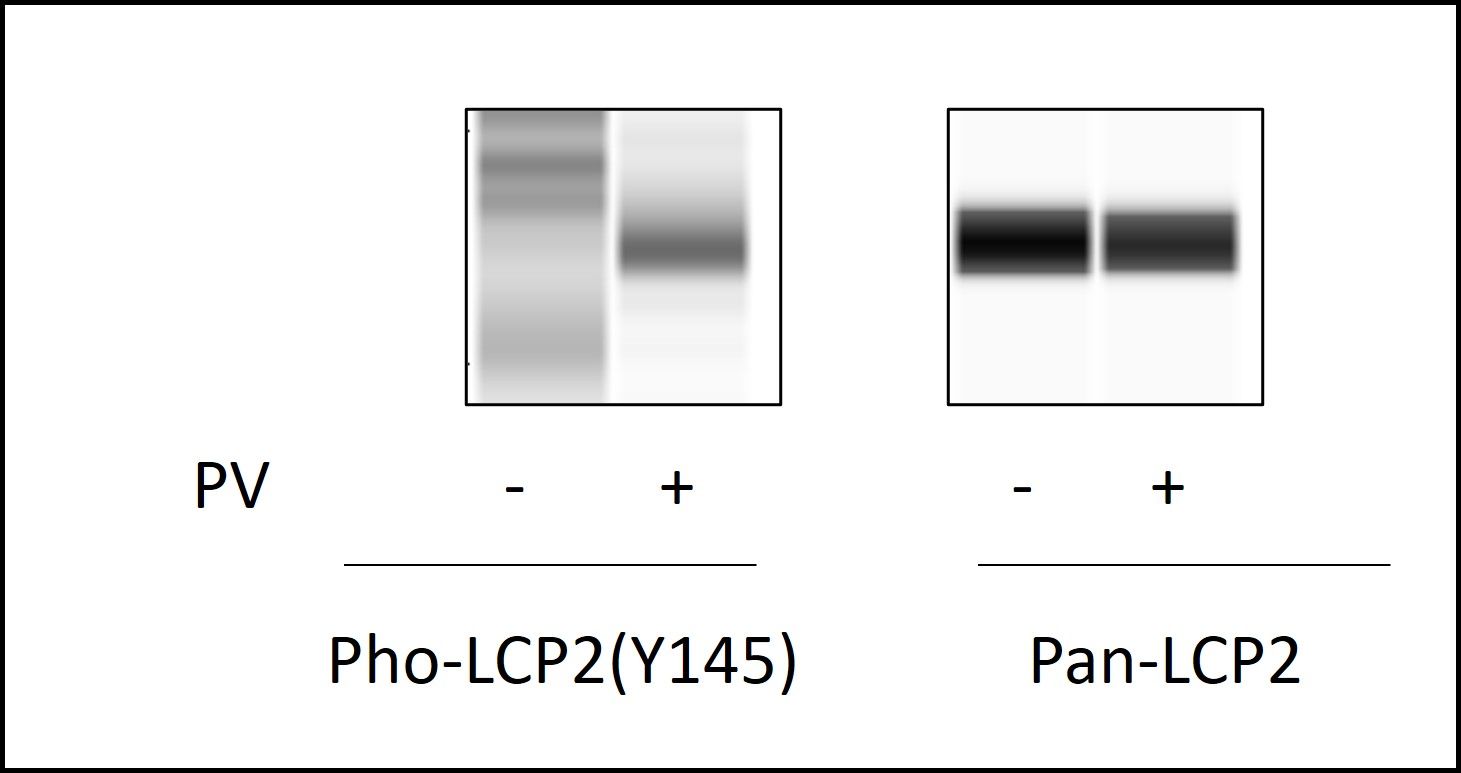 LCP2 (Y145) - Western Blot Analysis