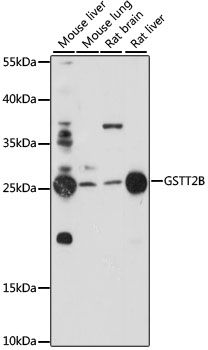 Western blot - GSTT2B antibody (144-611203)