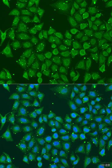 Immunofluorescence - AKR7A3 antibody (144-08194)