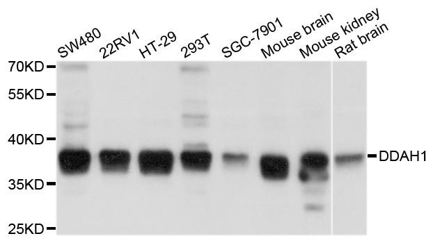 Western blot - DDAH1 Polyclonal Antibody (144-10295)