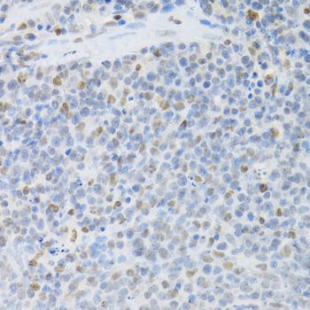 Immunohistochemistry - SFN Polyclonal Antibody (144-01026)