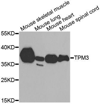 Western blot - TPM3 antibody (144-013557)
