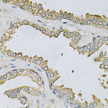 Immunohistochemistry - APRT Antibody (144-60530)