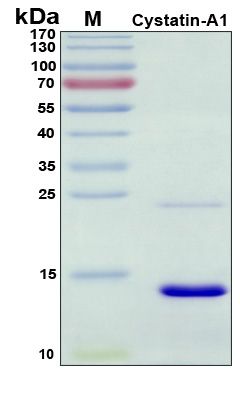 SDS-PAGE