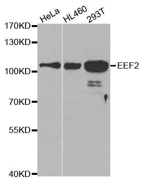 Western blot - EEF2 antibody (144-02068)