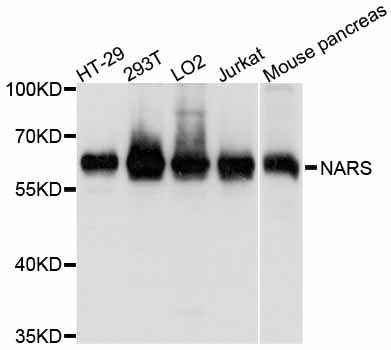 Western blot - NARS antibody (144-600728)
