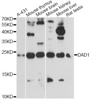 Western blot - DAD1 antibody (144-60764)