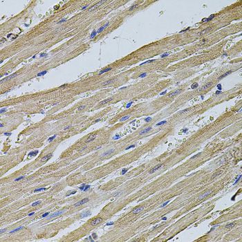 Immunohistochemistry - EIF4A2 Polyclonal Antibody (144-03849)