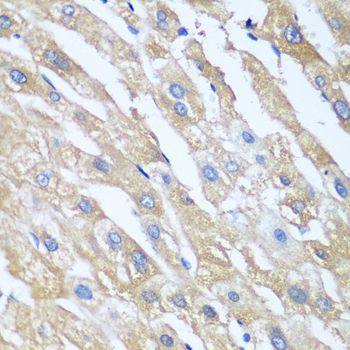 Immunohistochemistry - PPP4R1 Polyclonal Antibody (144-08361)
