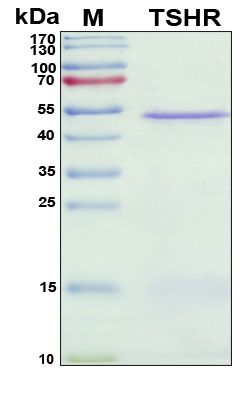 SDS-PAGE