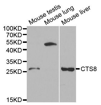 Western blot - CST8 antibody (144-01224)