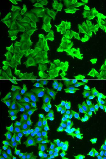 Immunofluorescence - RPLP0 antibody (144-013633)