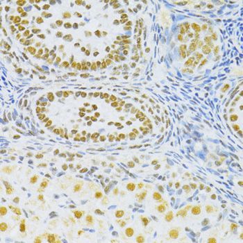 Immunohistochemistry - SNRNP70 antibody (144-06065)