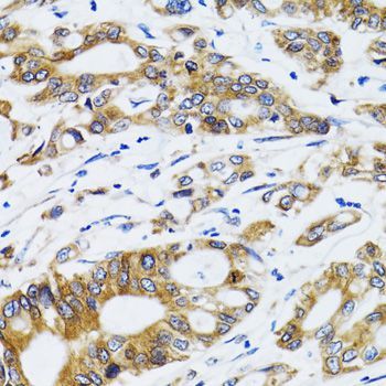 Immunohistochemistry - PGRMC1 antibody (144-05619)