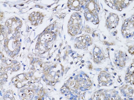 Immunohistochemistry - BRCA1 Polyclonal Antibody (144-00212)