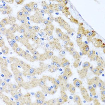 Immunohistochemistry - CETN3 antibody (144-08111)