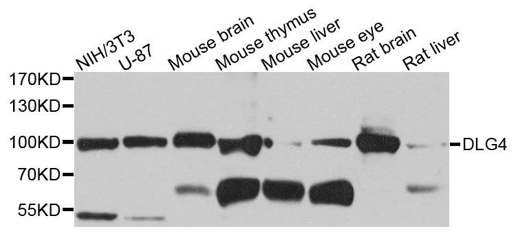 Western blot - DLG4 Polyclonal Antibody (144-07889)