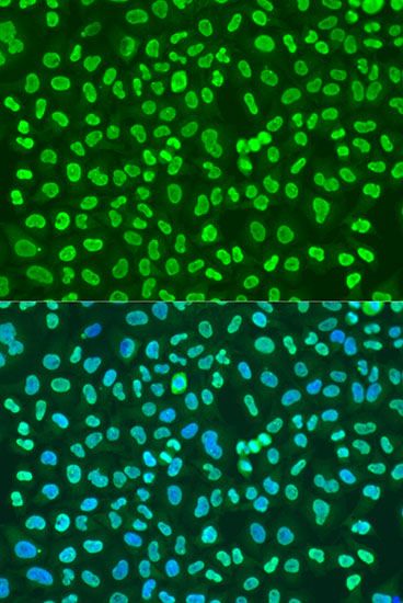 Immunofluorescence - PTBP1 antibody (144-06107)