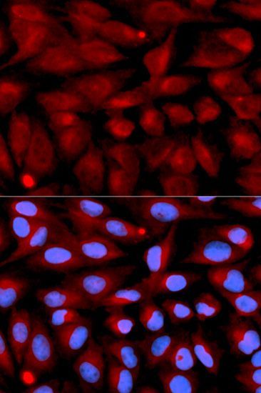 Immunofluorescence - CD70 antibody (144-02032)