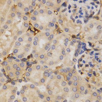 Immunohistochemistry - ELAVL1 Polyclonal Antibody (144-01608)