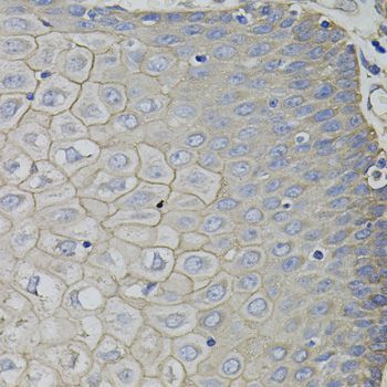 Immunohistochemistry - CKAP4 Polyclonal Antibody (144-07777)