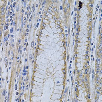 Immunohistochemistry - MVP Antibody (144-01980)