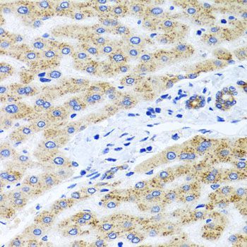 Immunohistochemistry - PEX14 antibody (144-07336)
