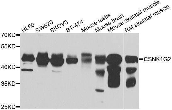 Western blot - CSNK1G2 antibody (144-07326)