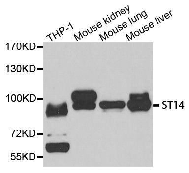 Western blot - ST14 antibody (144-06135)