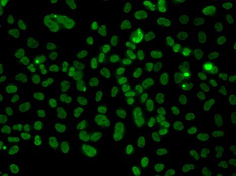 Immunofluorescence - PLCXD2 antibody (144-07615)