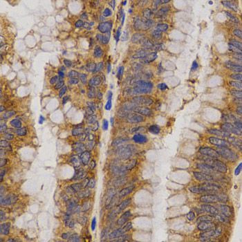 Immunohistochemistry - MMP25 Polyclonal Antibody (144-03032)
