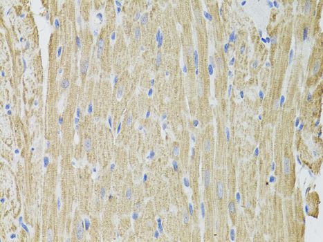 Immunohistochemistry - FHIT antibody (144-01196)