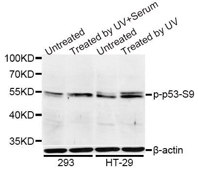 Western blot - Phospho-p53-S9 pAb (144-50085)