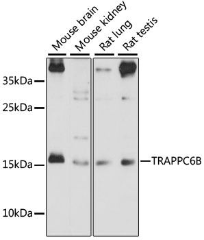 Western blot - TRAPPC6B antibody (144-61111)