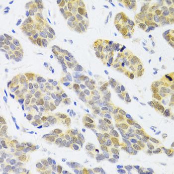 Immunohistochemistry - RFC4 Polyclonal Antibody (144-05485)