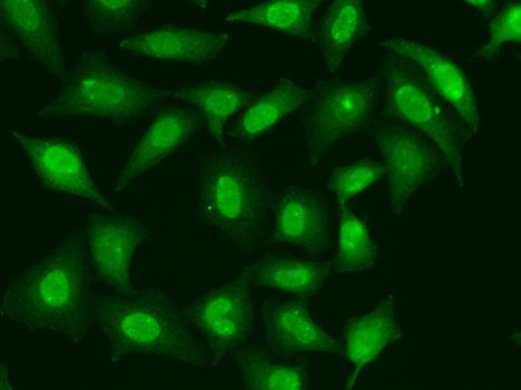 Immunofluorescence - TREX1 Polyclonal Antibody (144-06778)