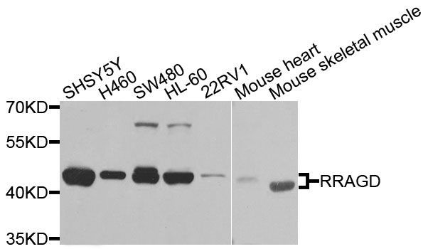 Western blot - RRAGD antibody (144-09979)