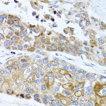 Immunohistochemistry - PEX14 antibody (144-07336)